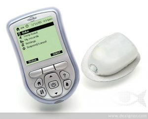  Continuous Blood Glucose Monitor