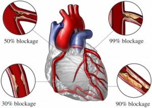 elevated blood glucose