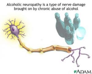 neuropathy cures