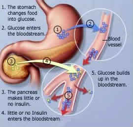 what are the symptoms of diabetes