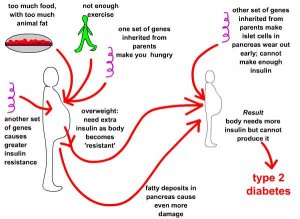 What is the Cause of Diabetes?